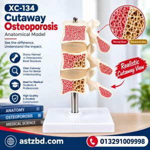 Osteoporosis bone model XC-134 front view with cutaway section